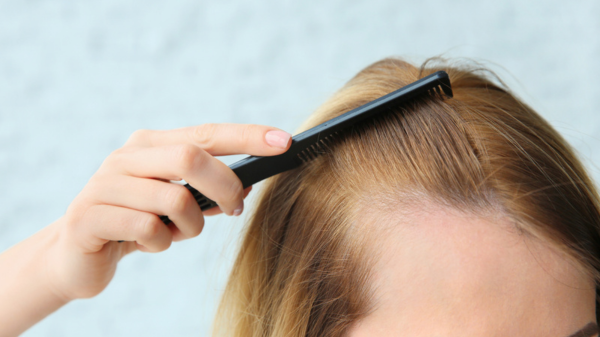 Combatting Hair Loss: Expert Tips by Colorproof