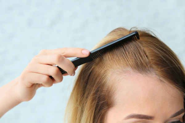 Combatting Hair Loss: Expert Tips by Colorproof